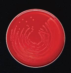Trypticase™ Soy Agar with 5% Sheep Blood