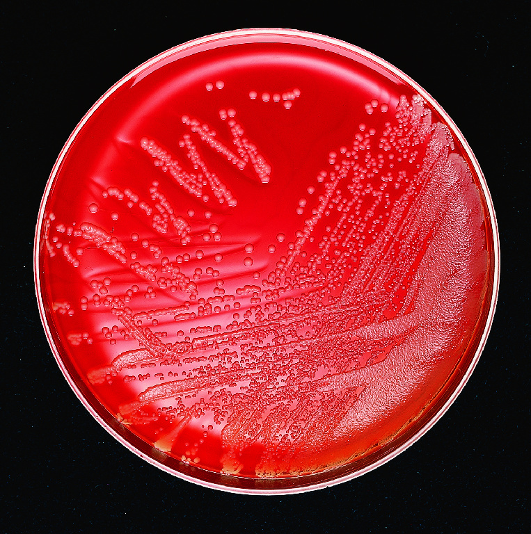 Columbia Agar with 5% Sheep Blood