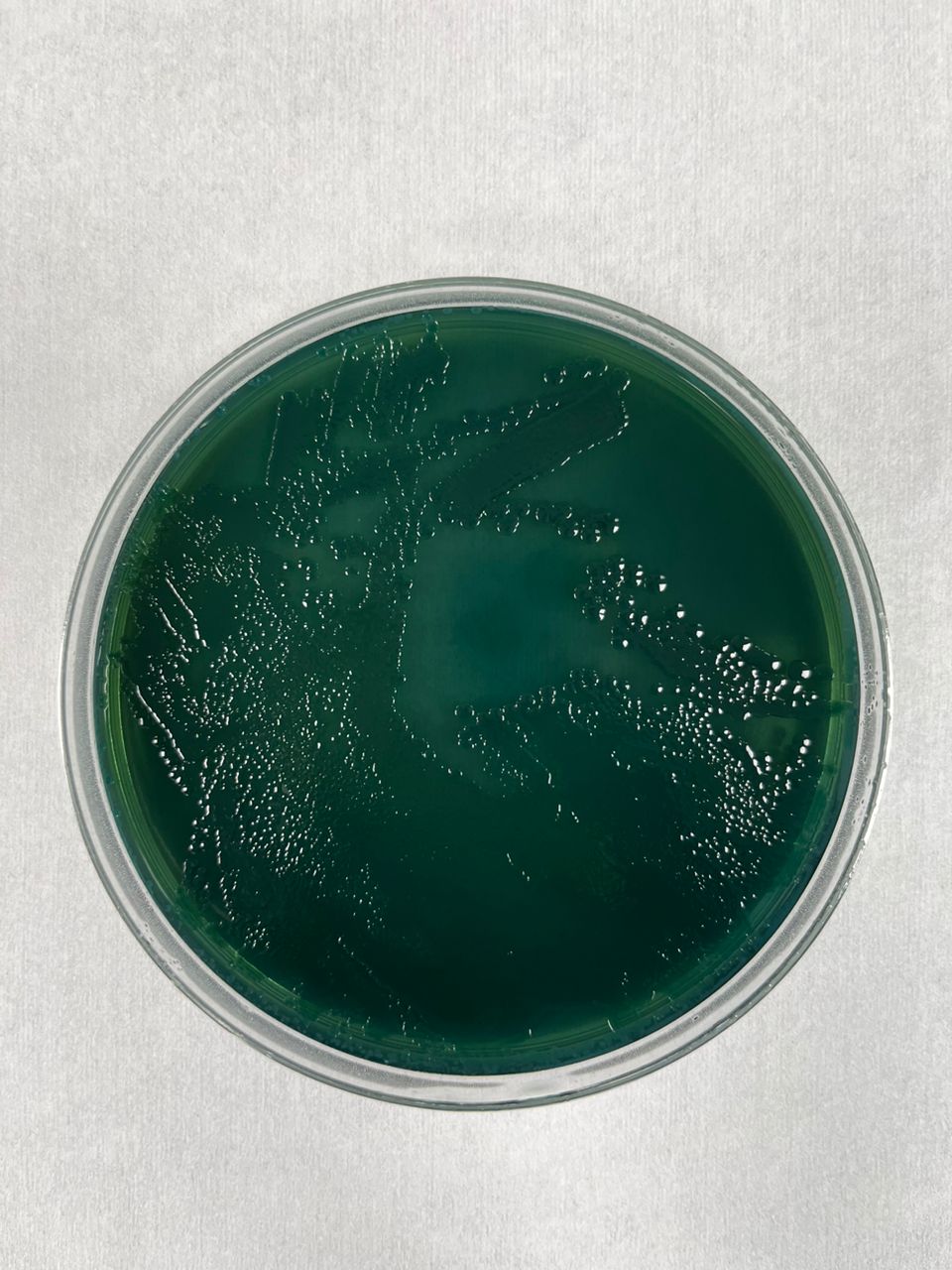 TCBS-Agar